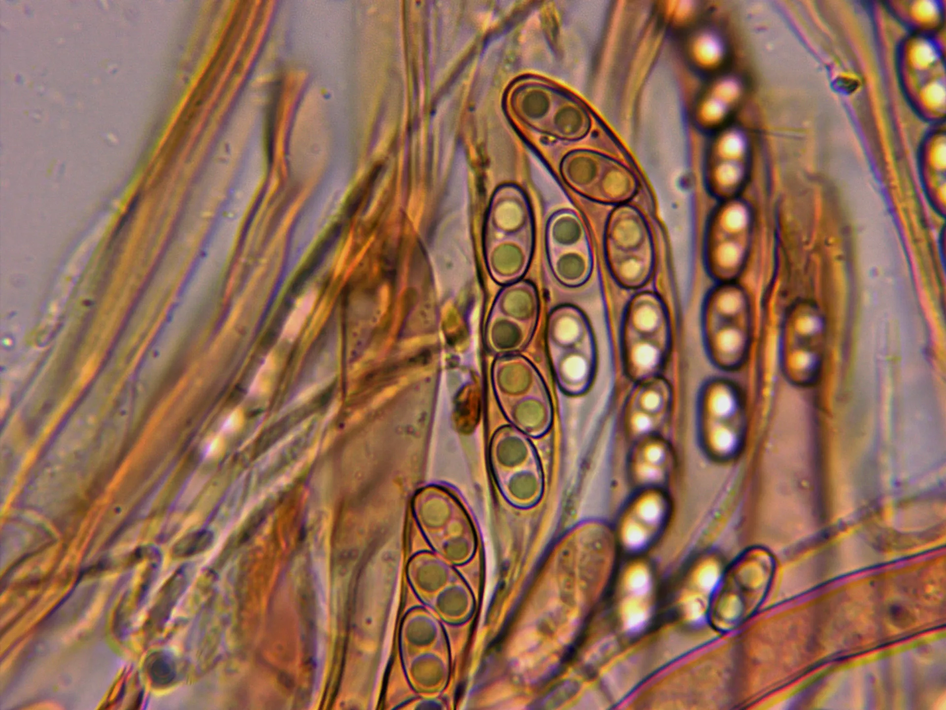 Microscopía de Otidea subformicarum - 10 - Ascas